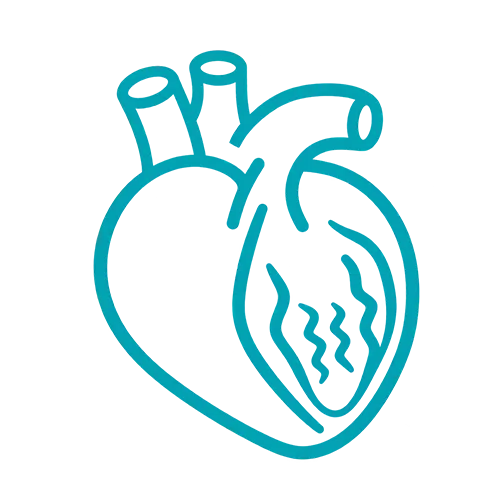 Cardiomyopathy